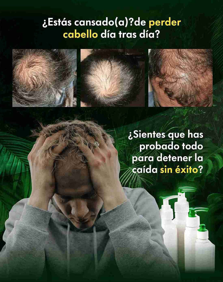 ELHOE - HAIR suero para el crecimiento del cabello