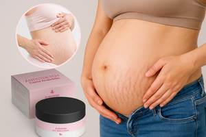 Crema Antiestrias